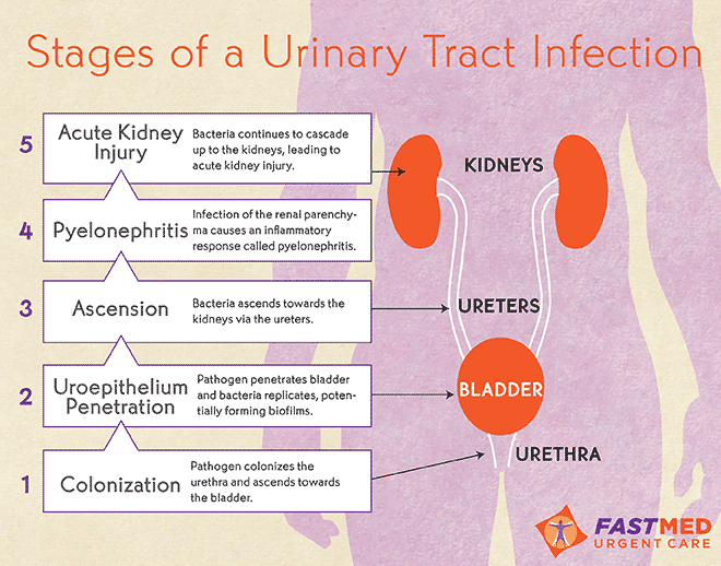 Fastmed Urgent Care Urinary Tract Infection Infographic 