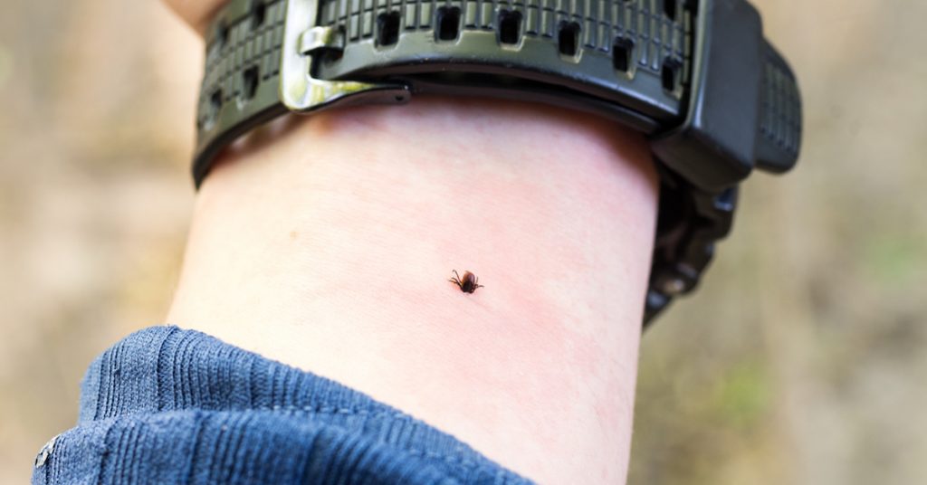 Picture of a tick on a man's arm.
