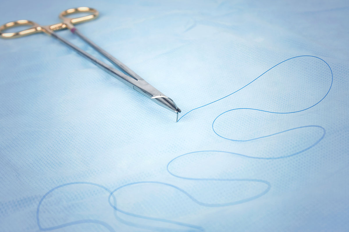 Dissolvable stitches: How long they last, care tips, and removal